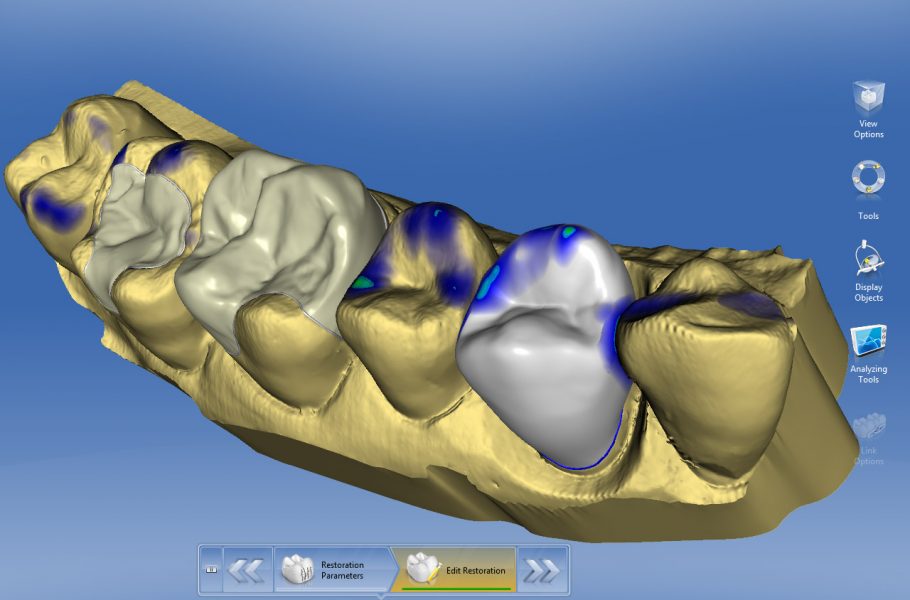 CAD/CAM моделирование зубов