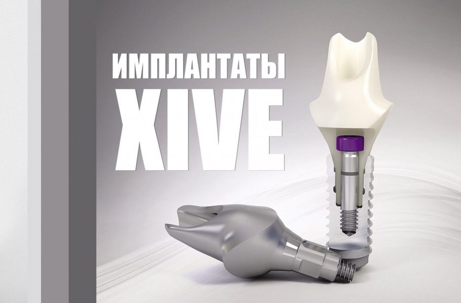 Имплантация зубов Xive