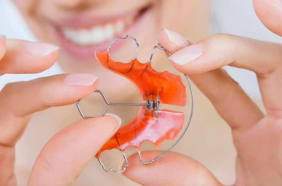 Ортодонтические пластинки для исправления прикуса