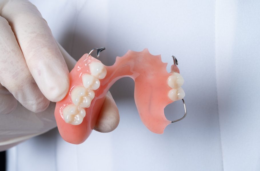 Протезирование при частичном отсутствии зубов